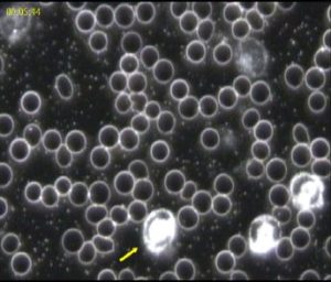 Red blood cells (with neurophils) of regular size and shape. Fibrin is absent.