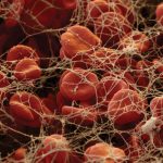 Fibrinogen and Blood Clots